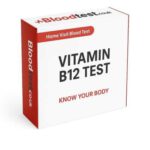 Vitamin B12 Blood Test: Key Insights for Residents of Southampton