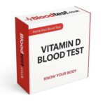 Vitamin D Blood Test Guide for Residents of Norwich