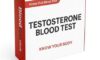 Low Testosterone Blood Tests Now Offered in Southampton